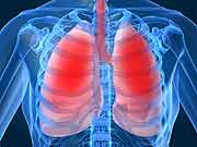 COPD - atrial fibrilation